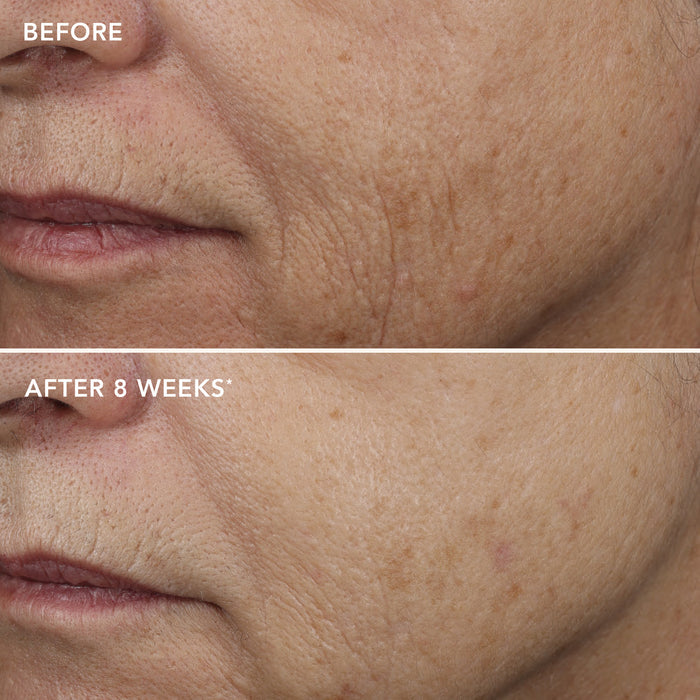 Before and after images of face after 8 weeks of use