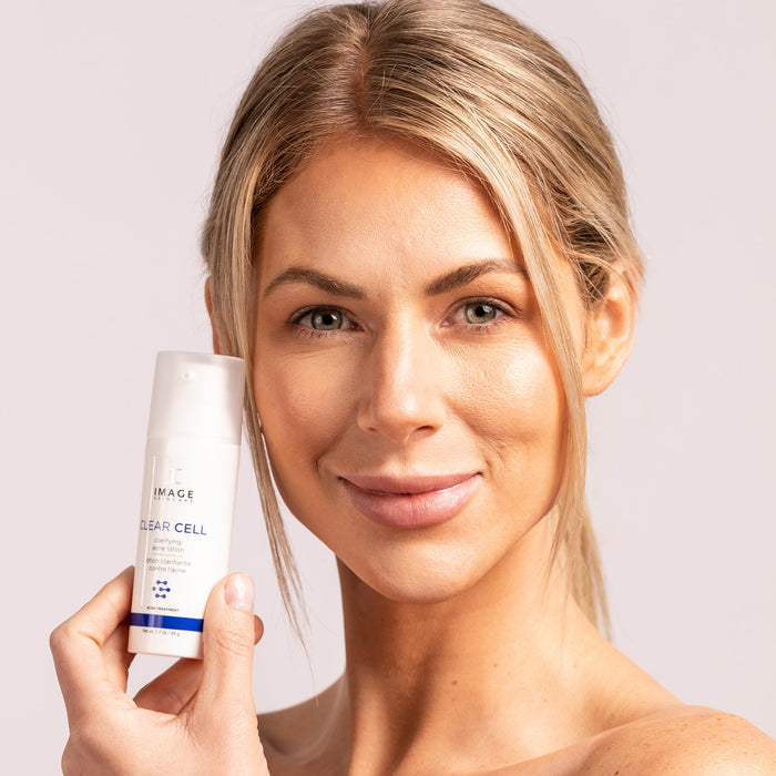 model holding acne lotion bottle up to face