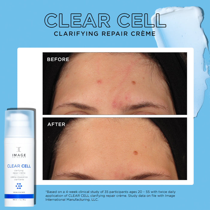 CLEAR CELL clarifying repair crème before and after showing results after 4 weeks