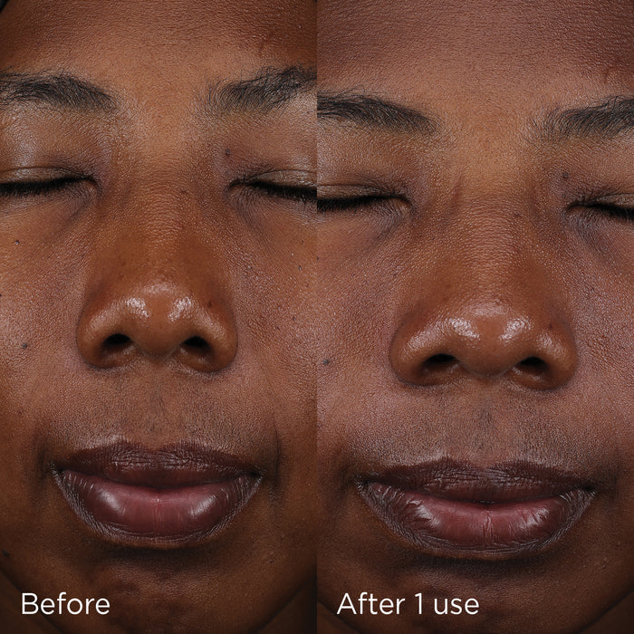 Before and after images of model showing product results after 1 use
