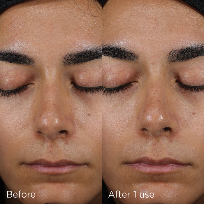 before and after one use image