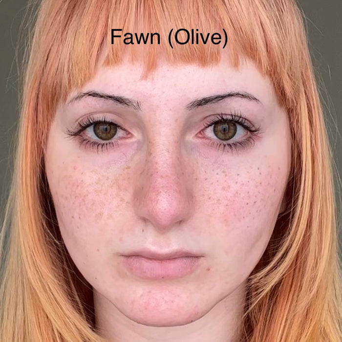 Freckle Pen
