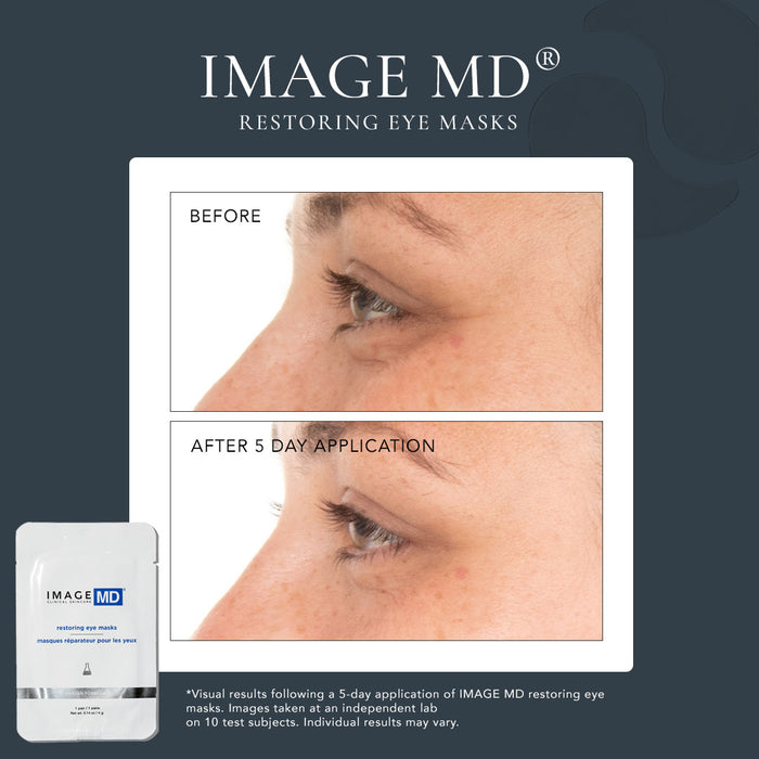 before and after shot of model profile showing results after 5 days